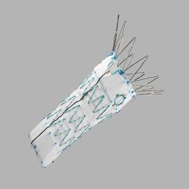 Zenith® Fenestrated AAA Endovascular Graft Proximal Body Grafts